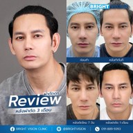 Bright Vision Clinic