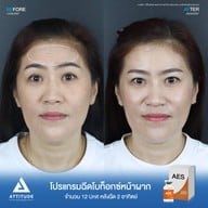 เมนูของร้าน Attitude Clinic ลำปาง