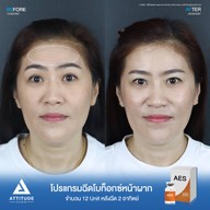 เมนูของร้าน Attitude Clinic  ห้วยขวาง