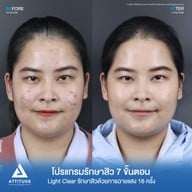เมนูของร้าน Attitude Clinic ลำปาง
