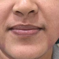 เมนูของร้าน ProDerma Aesthetic Clinics สนามเป้า