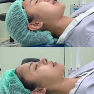 ALINE Clinic by หมอภูวิช ดึงหน้า เสริมจมูกโอเพ่น ตาสองชั้น โคราช