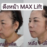 เมนูของร้าน MAXi Cosmetic Surgery