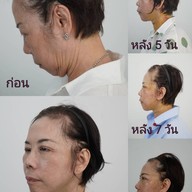 เมนูของร้าน MAXi Cosmetic Surgery
