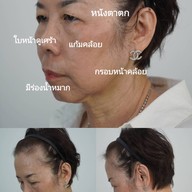 เมนูของร้าน MAXi Cosmetic Surgery