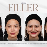 Amarante Clinic (อะมารันเต้ คลินิก) อารีย์ : อาคารบ้านยสวดี (BTS อารีย์ ทางออกที่ 3)