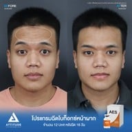 เมนูของร้าน Attitude Clinic  ห้วยขวาง