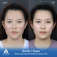 เมนูของร้าน Attitude Clinic ลำปาง