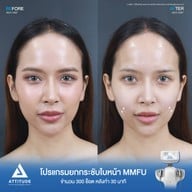 เมนูของร้าน ATTITUDE CLINIC เชียงใหม่