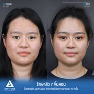 เมนูของร้าน Attitude Clinic  ห้วยขวาง