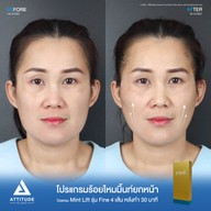 เมนูของร้าน ATTITUDE CLINIC เชียงใหม่