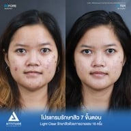 เมนูของร้าน ATTITUDE CLINIC เชียงใหม่