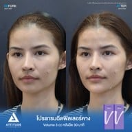 เมนูของร้าน Attitude Clinic  ห้วยขวาง