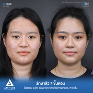 เมนูของร้าน ATTITUDE CLINIC เชียงใหม่