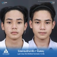 เมนูของร้าน Attitude Clinic ลำปาง