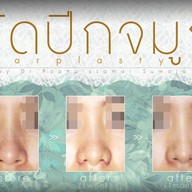 เมนูของร้าน มาดาม คลาสสิก ศัลยกรรมตกแต่ง (Madame Classique) อ่อนนุช 30