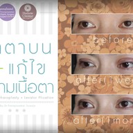 เมนูของร้าน มาดาม คลาสสิก ศัลยกรรมตกแต่ง (Madame Classique) อ่อนนุช 30