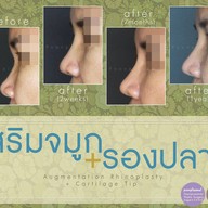 เมนูของร้าน มาดาม คลาสสิก ศัลยกรรมตกแต่ง (Madame Classique) อ่อนนุช 30