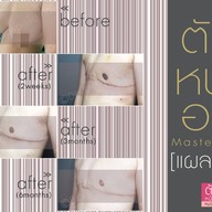 เมนูของร้าน มาดาม คลาสสิก ศัลยกรรมตกแต่ง (Madame Classique) อ่อนนุช 30