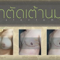 เมนูของร้าน มาดาม คลาสสิก ศัลยกรรมตกแต่ง (Madame Classique) อ่อนนุช 30