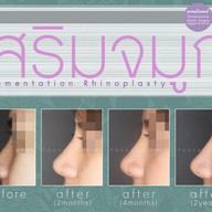 เมนูของร้าน มาดาม คลาสสิก ศัลยกรรมตกแต่ง (Madame Classique) อ่อนนุช 30