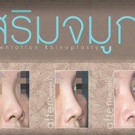 เมนูของร้าน มาดาม คลาสสิก ศัลยกรรมตกแต่ง (Madame Classique) อ่อนนุช 30