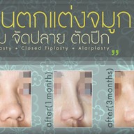 เมนูของร้าน มาดาม คลาสสิก ศัลยกรรมตกแต่ง (Madame Classique) อ่อนนุช 30