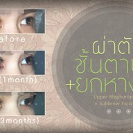 เมนูของร้าน มาดาม คลาสสิก ศัลยกรรมตกแต่ง (Madame Classique) อ่อนนุช 30