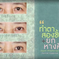 เมนูของร้าน มาดาม คลาสสิก ศัลยกรรมตกแต่ง (Madame Classique) อ่อนนุช 30