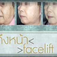 เมนูของร้าน มาดาม คลาสสิก ศัลยกรรมตกแต่ง (Madame Classique) อ่อนนุช 30
