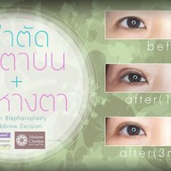 เมนูของร้าน มาดาม คลาสสิก ศัลยกรรมตกแต่ง (Madame Classique) อ่อนนุช 30