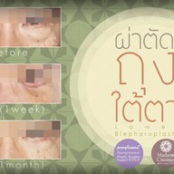 เมนูของร้าน มาดาม คลาสสิก ศัลยกรรมตกแต่ง (Madame Classique) อ่อนนุช 30
