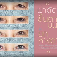 เมนูของร้าน มาดาม คลาสสิก ศัลยกรรมตกแต่ง (Madame Classique) อ่อนนุช 30