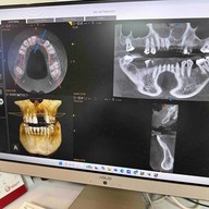 Dentalwise Clinic : เดนทอลไวส์คลินิก Invisalign Diamond Provider  ทองหล่อ