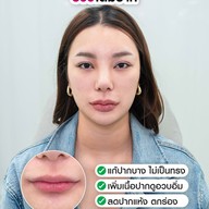 MEGA CLINIC สยามสแควร์