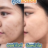 MEGA CLINIC สยามสแควร์