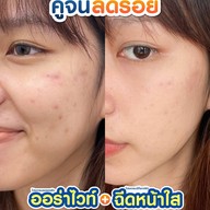 MEGA CLINIC เซ็นทรัลลาดพร้าว ชั้น9