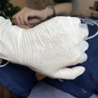 พี่กุ้งกดสิวสาขาโกสุมรวมใจ กดสิวดอนเมือง