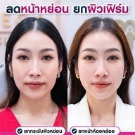 MEGA CLINIC เซ็นทรัลลาดพร้าว ชั้น9
