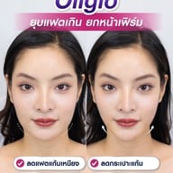 MEGA CLINIC สยามสแควร์