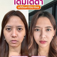 MEGA CLINIC เซ็นทรัลลาดพร้าว ชั้น9