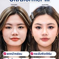 MEGA CLINIC เซ็นทรัลลาดพร้าว ชั้น9