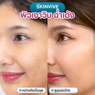 MEGA CLINIC เซ็นทรัลลาดพร้าว ชั้น9