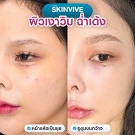 MEGA CLINIC สยามสแควร์