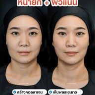 MEGA CLINIC เซ็นทรัลลาดพร้าว ชั้น9