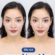 MEGA CLINIC สยามสแควร์