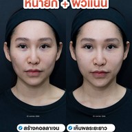 MEGA CLINIC สยามสแควร์