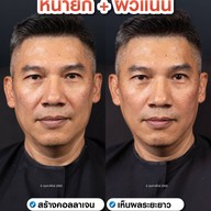 MEGA CLINIC เซ็นทรัลลาดพร้าว ชั้น9