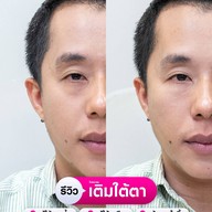 MEGA CLINIC เซ็นทรัลลาดพร้าว ชั้น9