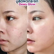 MEGA CLINIC สยามสแควร์